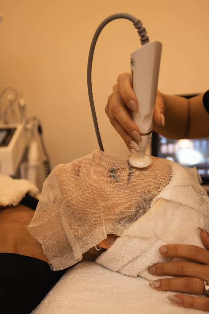 Facial Skincare Probe Treatment